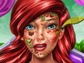 Spel Prinsessans Sjöjungfru Hudläkare på nätet