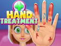 Spel Handbehandling på nätet
